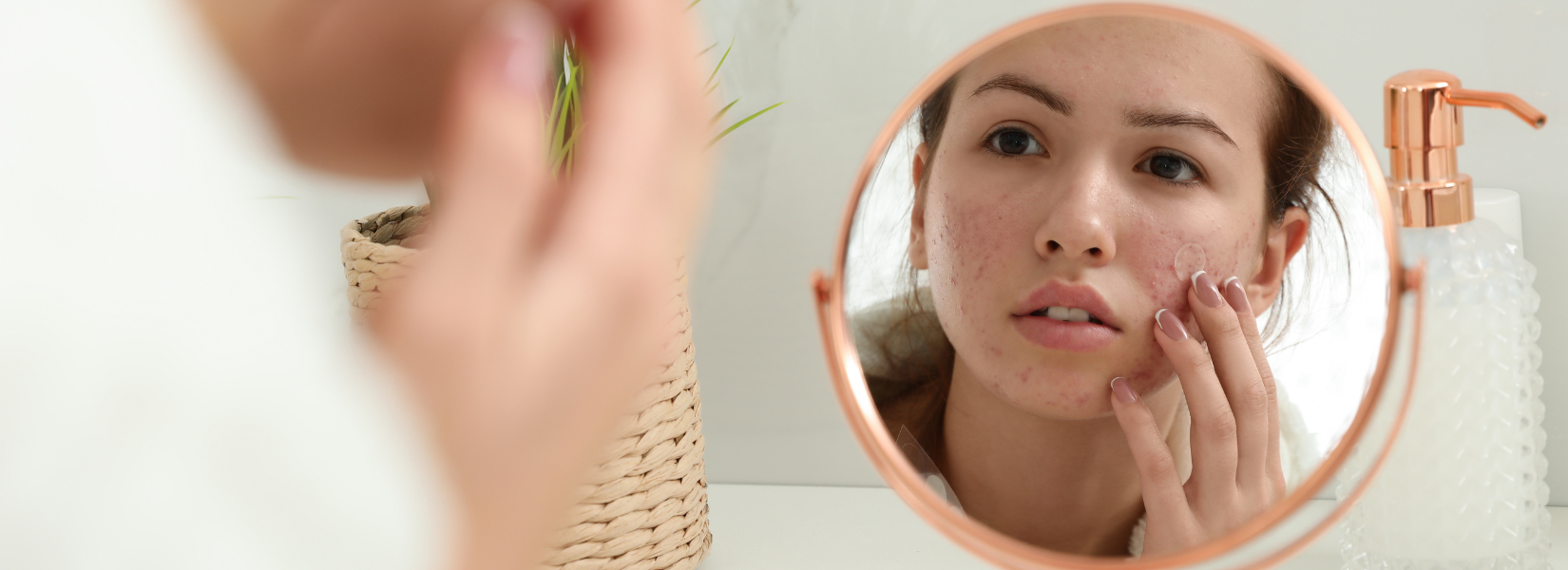 How to stop skin picking & heal breakouts